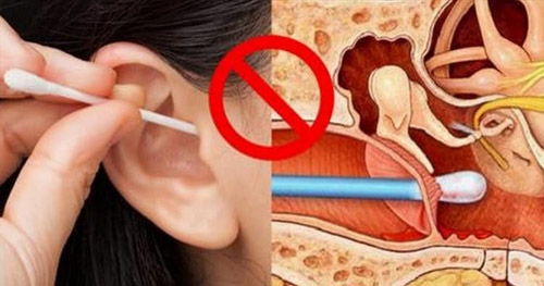 Nhiều người vẫn có thói quen lấy tăm bông ngoáy tai