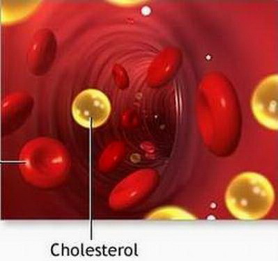 Clofibrate là thuốc chống tăng lipid máu