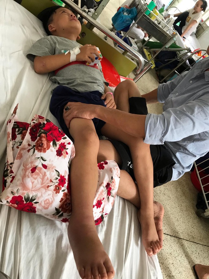Hình ảnh cháu Lê Nguyễn Đăng Quân đang điều trị tại Bệnh viện Nhi Đồng 2