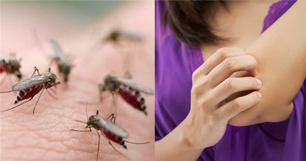 Nhóm máu O bị muỗi đốt cao hơn gấp 2 lần so với người nhóm máu khác