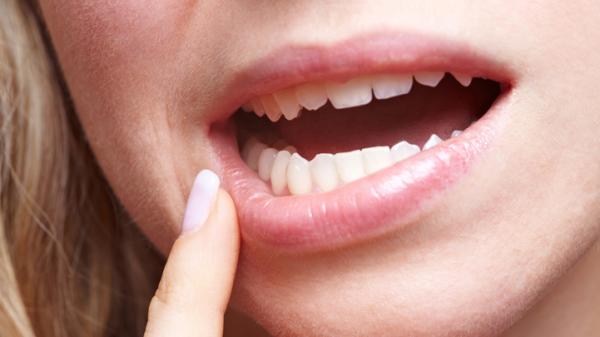 Thuốc Norash có thể gây ra tác dụng phụ như phát ban ở lưỡi hoặc môi