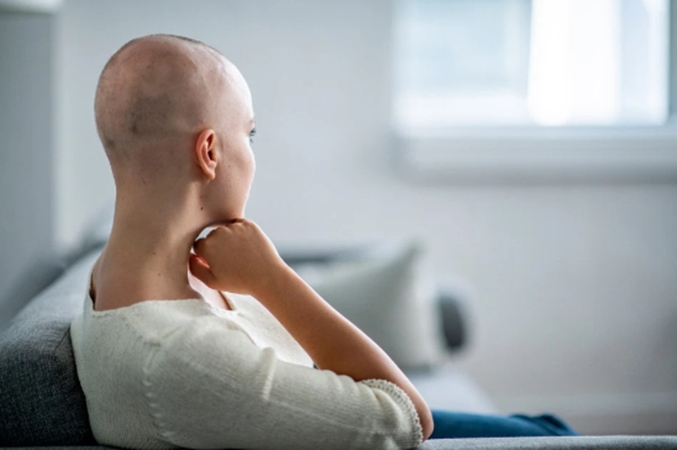 Bệnh nhân điều trị ung thư bị rụng tóc