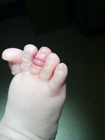 Theo các bác sĩ việc đeo bao tay bao chân cho trẻ sơ sinh là không cần thiết